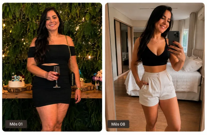 Foto ilustrativa de antes e depois do protocolo Evo