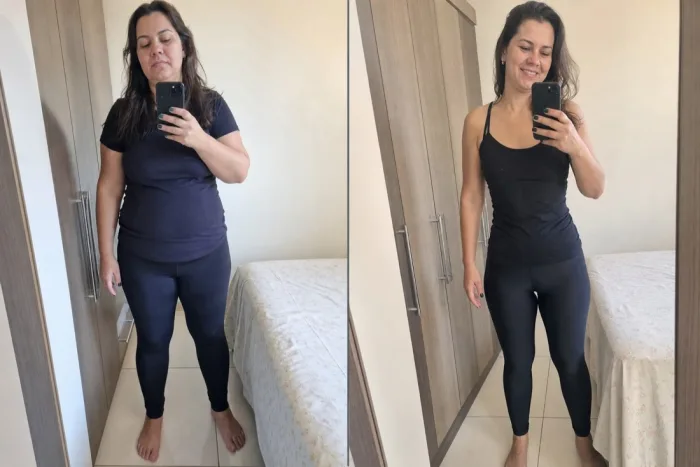 Foto ilustrativa de antes e depois do protocolo Evo