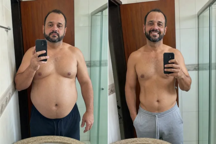 Foto ilustrativa de antes e depois do protocolo Evo